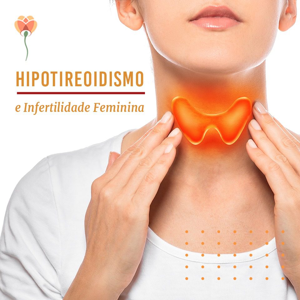 Hipotireoidismo e Infertilidade Feminina